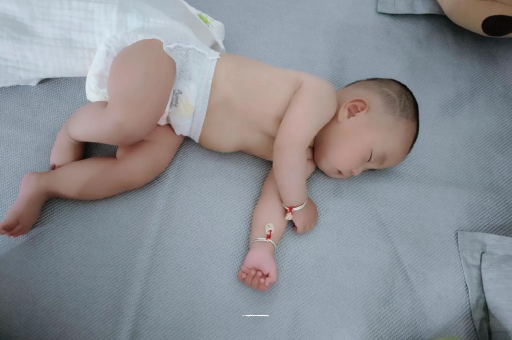 上杭宝宝头上长痱子